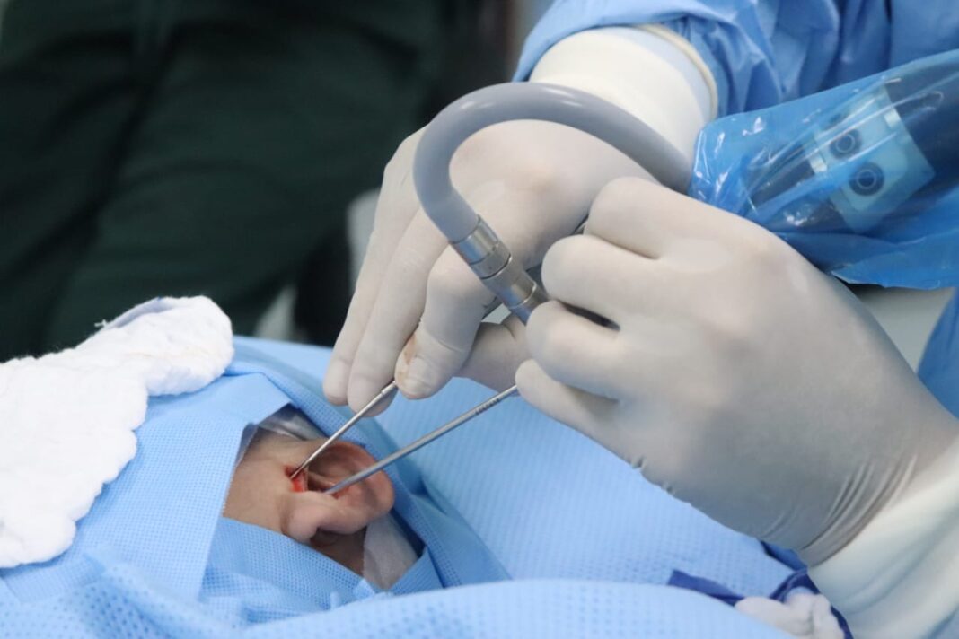 timpanoplastia IGSS Hospital General de Quetzaltenango-2