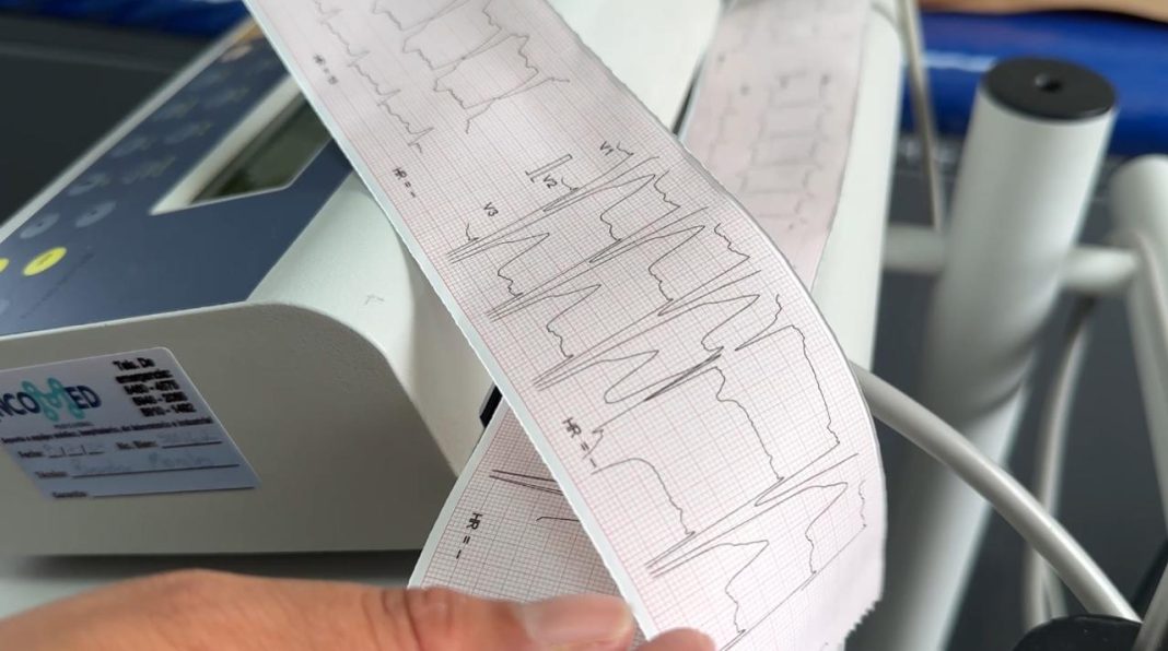electrocardiogramas IGSS-1