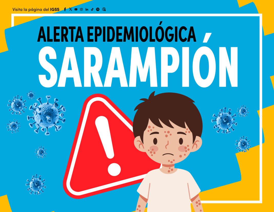 Alerta sarampion IGSS 2026