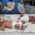 Medicos-del-Hospital-Dr-Juan-Jose-Arevalo-Bermejo-atienden-parto-de-trillizas-8