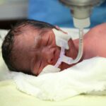 Medicos-del-Hospital-Dr-Juan-Jose-Arevalo-Bermejo-atienden-parto-de-trillizas-9