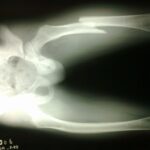 IGSS osteogenesis imperfecta hospital general de enfermedades guatemala-3