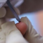 Dia Mundial de la Diabetes Consulta Externa Autonomia IGSS 2018-2
