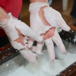 tratamiento de lesiones de miembros superiores camip pamplona igss 2019 parafina-3