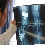 operacion de rodilla artroplastia hospital de accidentes igss 2019-10