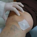 operacion de rodilla artroplastia hospital de accidentes igss 2019-13