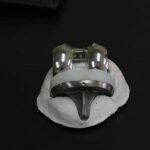 operacion de rodilla artroplastia hospital de accidentes igss 2019-15