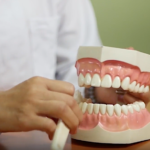 retraccion gingival igss-4