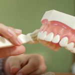 retraccion gingival igss-5
