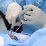 timpanoplastia IGSS Hospital General de Quetzaltenango-1