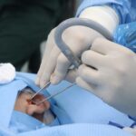 timpanoplastia IGSS Hospital General de Quetzaltenango-2