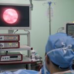 timpanoplastia IGSS Hospital General de Quetzaltenango-5