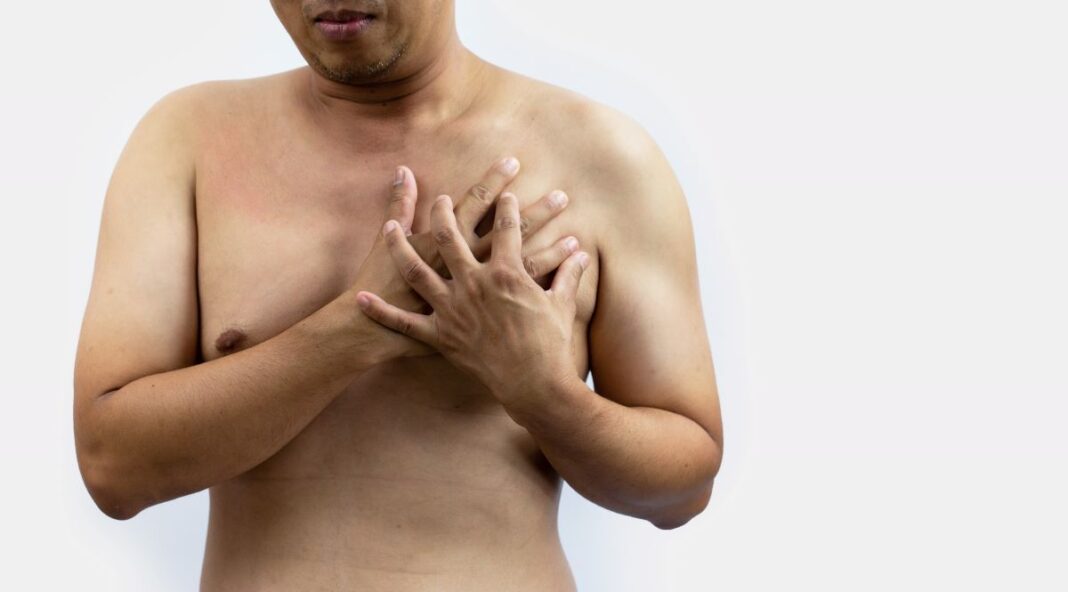 IGSS-mes-de-prevencion-cancer-Hombres-cancer-20254