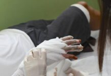 En el Día Mundial contra la Lepra el IGSS informa, previene y cuida