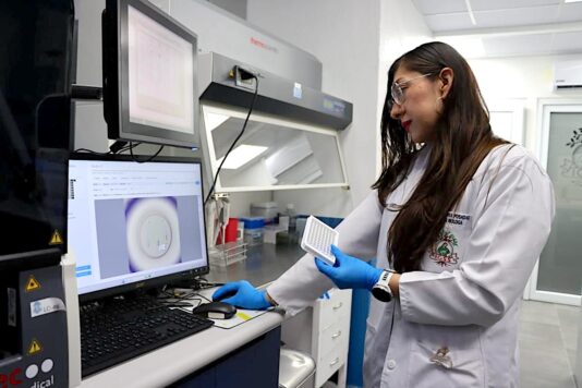 Panel de Autoinmunidad de Alta Cobertura en Laboratorio Clínico de HGE