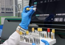 El HGE fortalece la detección del sarampión mediante diagnósticos especializados
