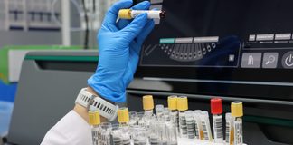 El HGE fortalece la detección del sarampión mediante diagnósticos especializados